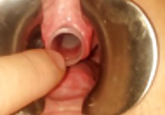 Glatzköpfiger Arzt fickte schwarze Titten erotikfilme gratis ab